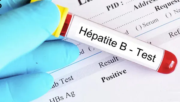 Groundnut Basin: Hepatitis B Prevalence at over 10%